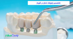 متخصص ایمپلنت دندان در شیراز