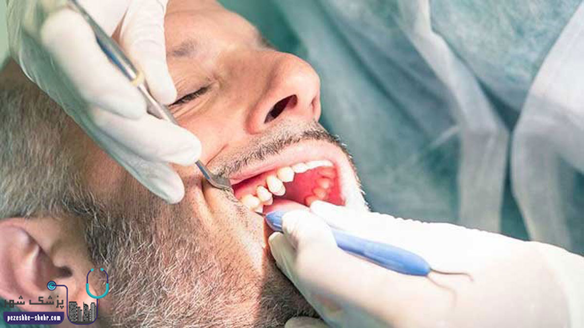 دندانپزشک متخصص جراحی لثه در شیراز