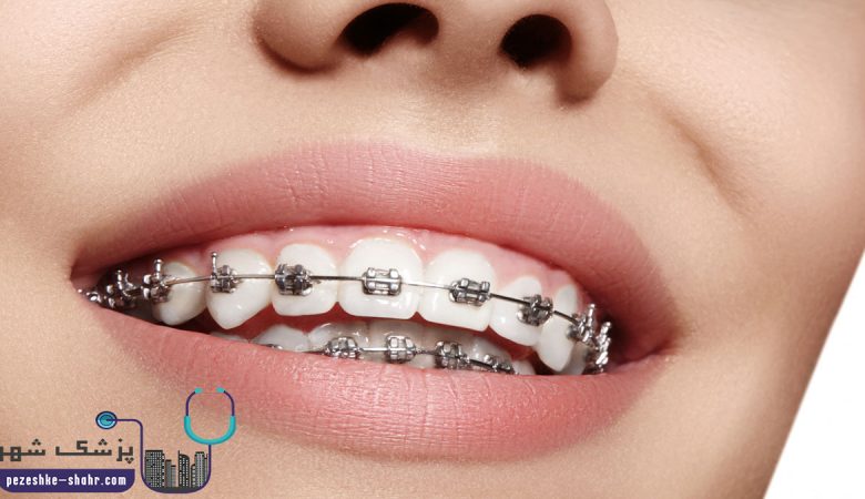 دندانپزشک متخصص ارتودنسی دندان در شیراز