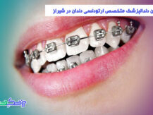 بهترین دندانپزشک متخصص ارتودنسی دندان در شیراز