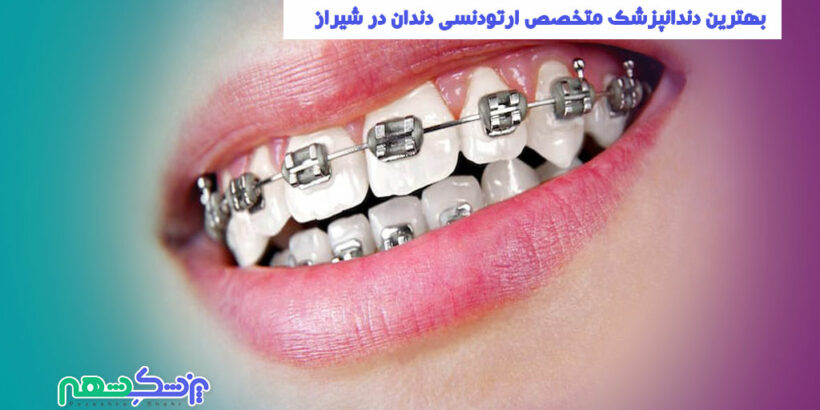 بهترین دندانپزشک متخصص ارتودنسی دندان در شیراز