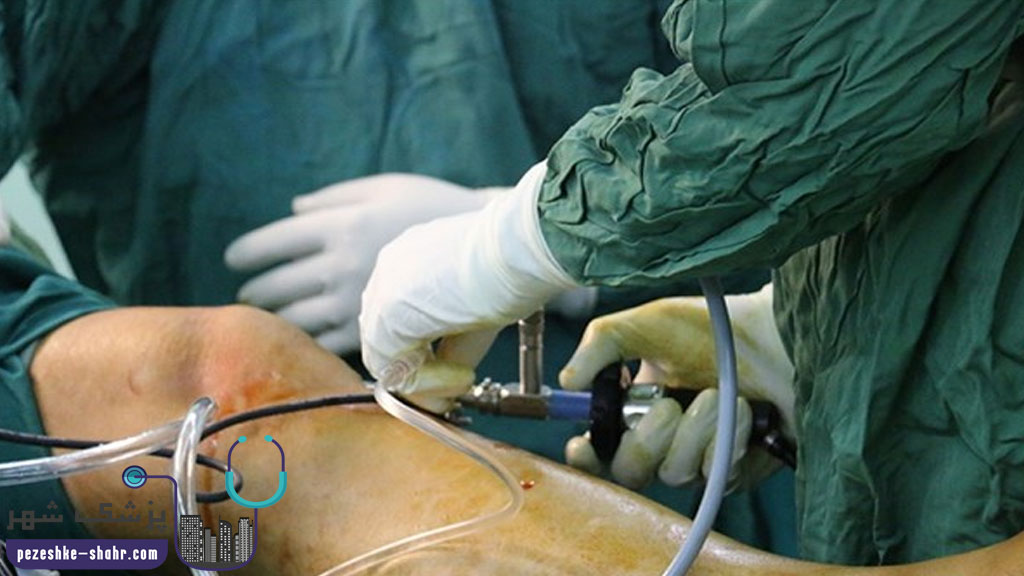 لیست پزشکان فوق تخصص جراحی زانو در شیراز
