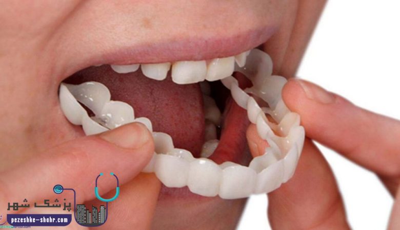 دندانپزشکان متخصص پروتز دندانی در شیراز