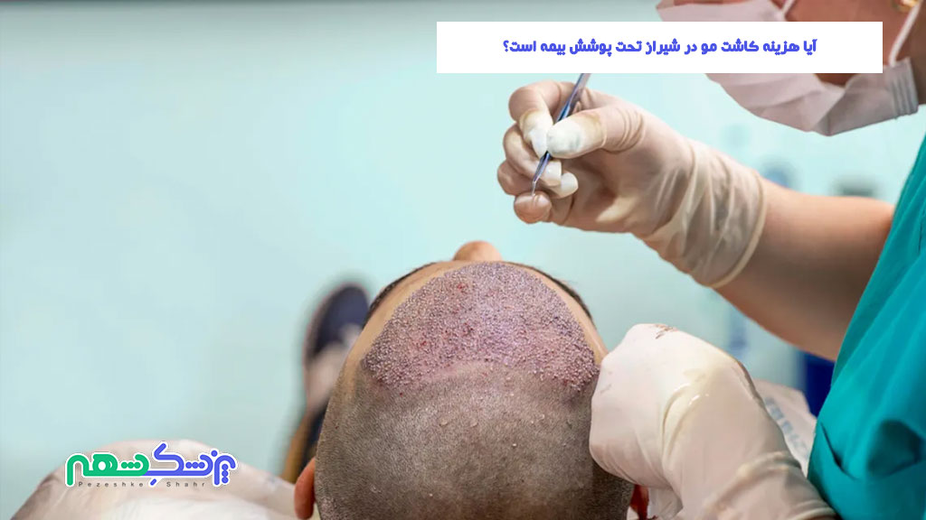 آیا هزینه کاشت مو در شیراز تحت پوشش بیمه است؟