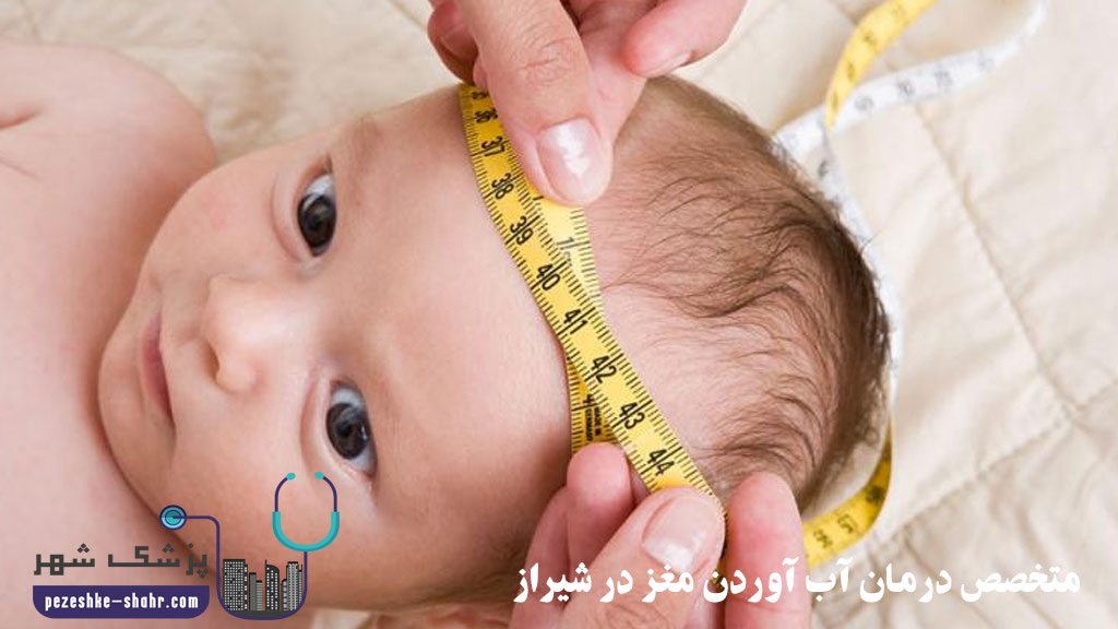 متخصص درمان آب آوردن مغز در شیراز