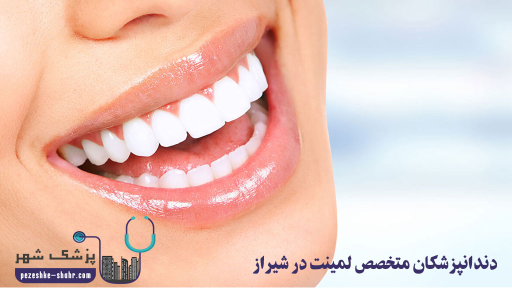 دندانپزشکان متخصص لمینت در شیراز