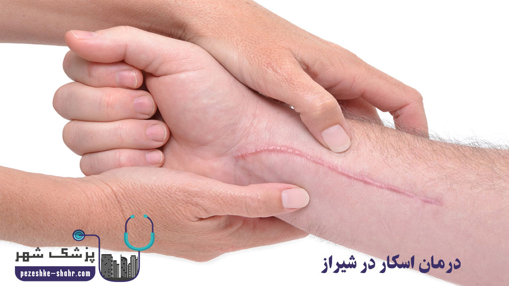 درمان اسکار در شیراز