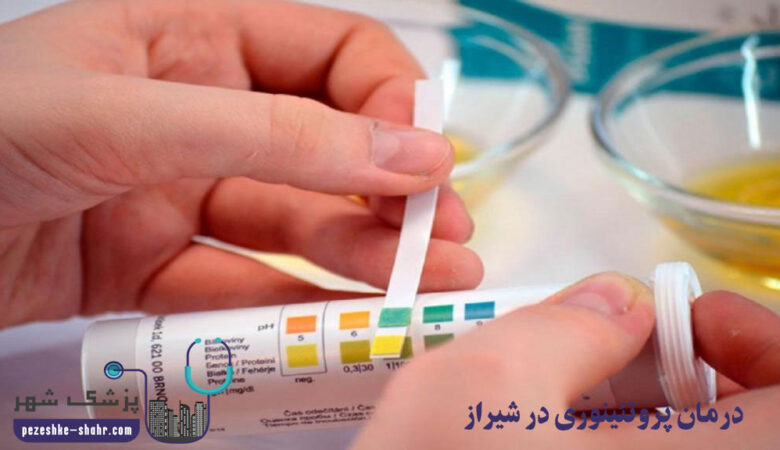 درمان پروتئینوری در شیراز