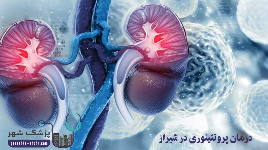 درمان پروتئینوری در شیراز