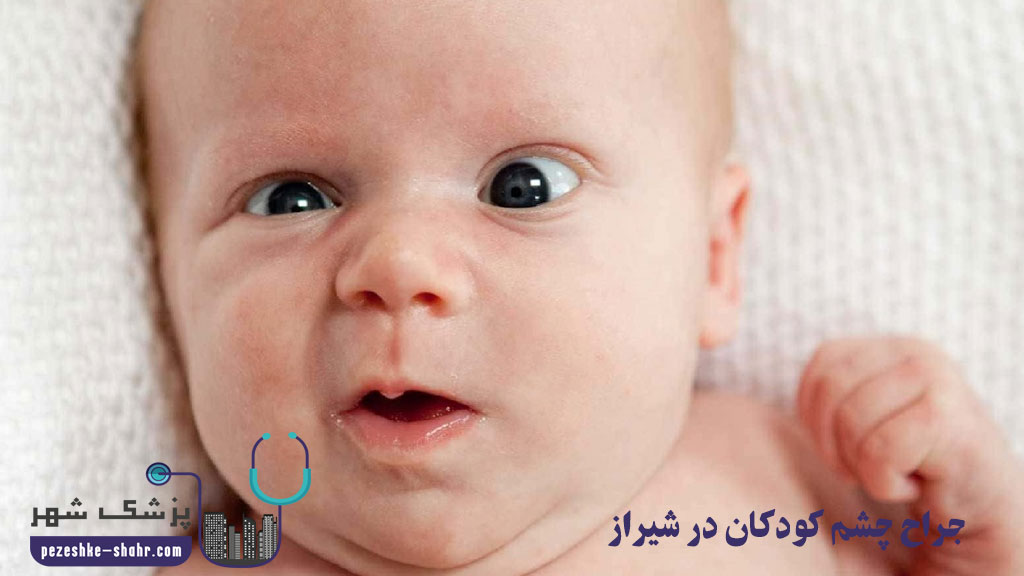 جراح چشم کودکان در شیراز 