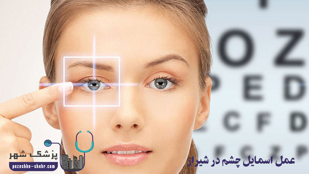 متخصص عمل اسمایل چشم در شیراز