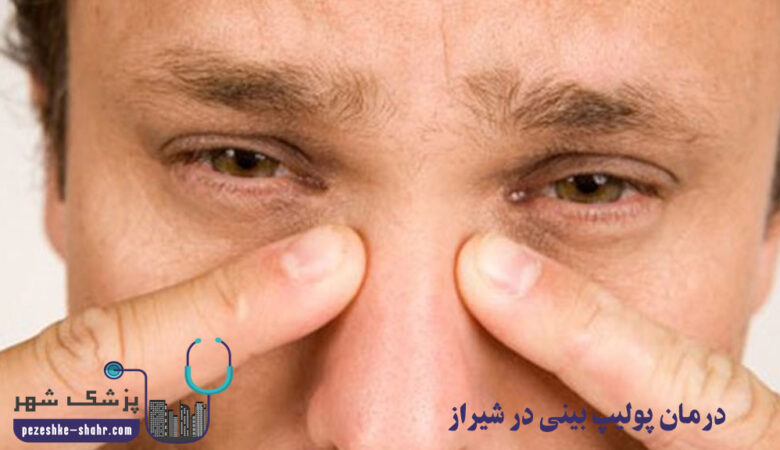 درمان پولیپ بینی در شیراز