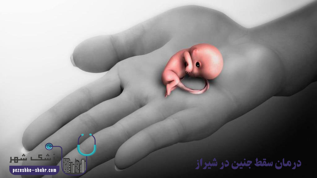 درمان سقط جنین در شیراز