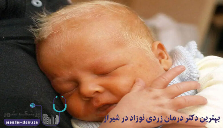 دکتر درمان زردی نوزاد در شیراز