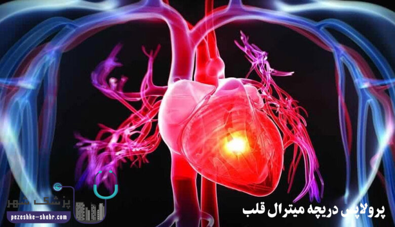 پرولاپس دریچه میترال قلب 