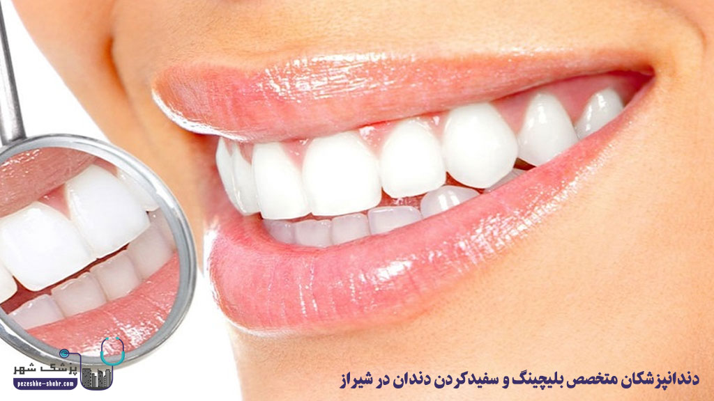 بلیچینگ و سفیدکردن دندان در شیراز