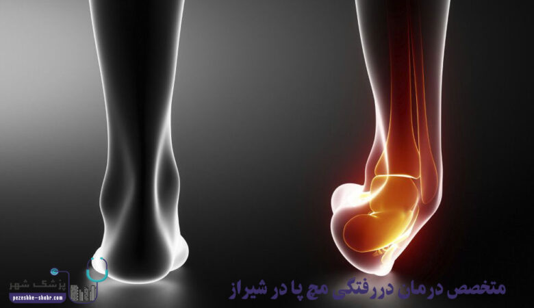 متخصص درمان دررفتگی مچ پا در شیراز