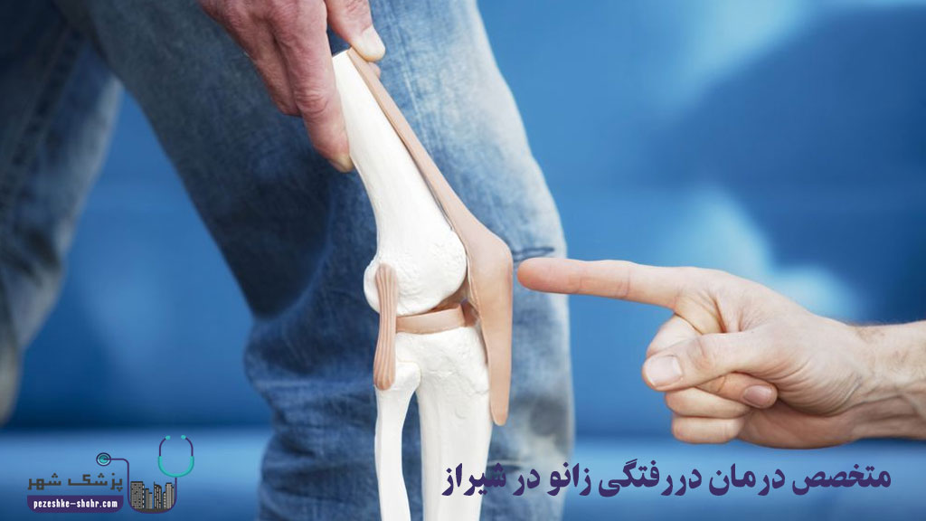 متخصص درمان دررفتگی زانو در شیراز