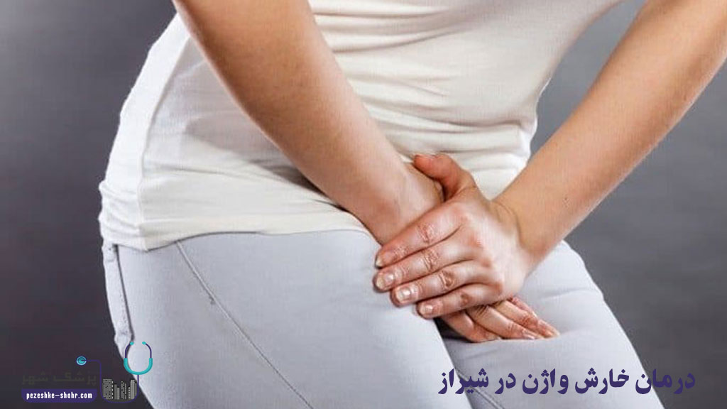 درمان خارش واژن در شیراز