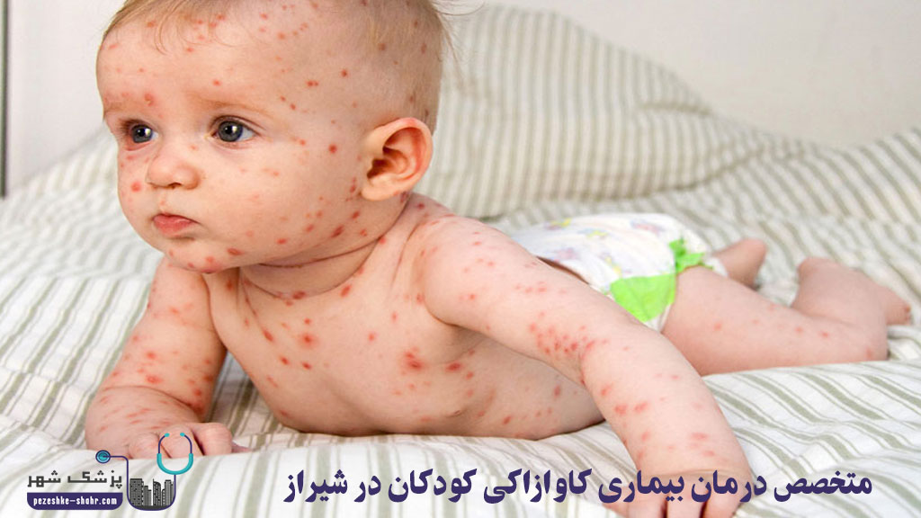 متخصص درمان بیماری کاوازاکی کودکان در شیراز