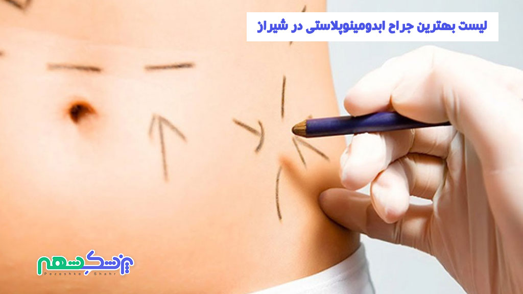 لیست بهترین جراح ابدومینوپلاستی در شیراز
