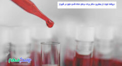 درمان لخته شدن خون در رگ در شیراز