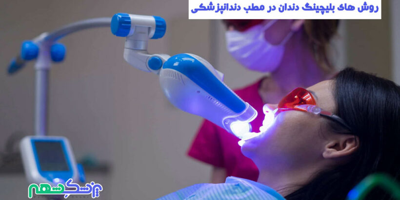 روش های بلیچینگ دندان در مطب دندانپزشکی