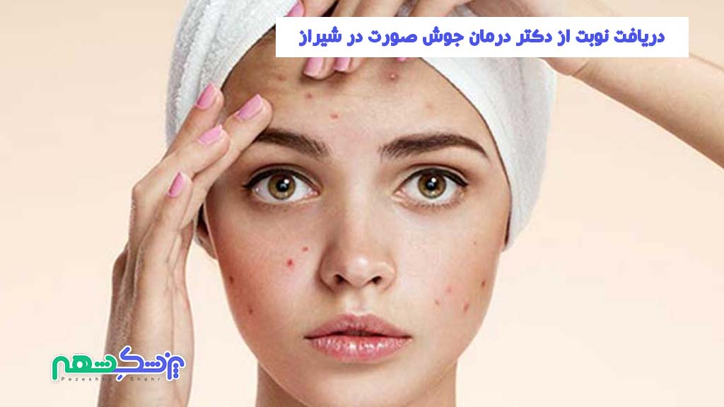 دریافت نوبت از دکتر درمان جوش صورت در شیراز