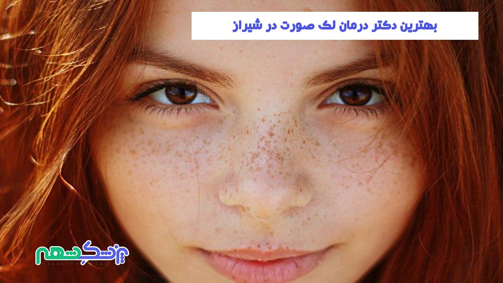 دریافت نوبت از دکتر برای درمان لک صورت در شیراز