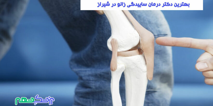 درمان ساییدگی زانو در شیراز