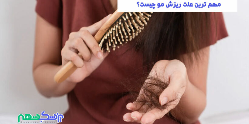 مهم ترین علت ریزش مو چیست؟