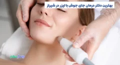 درمان جای جوش با لیزر در شیراز