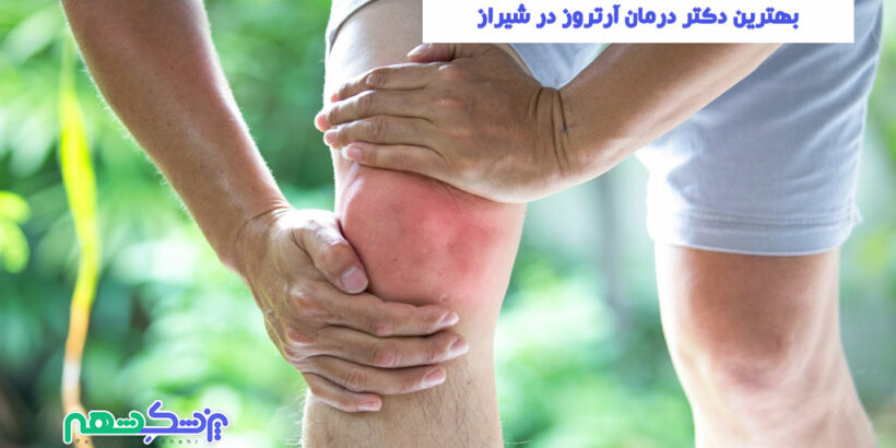 بهترین دکتر درمان آرتروز در شیراز