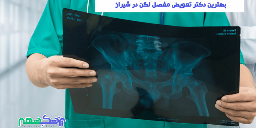 بهترین دکتر تعویض مفصل لگن در شیراز