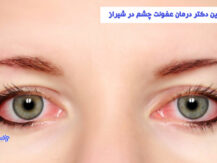 درمان عفونت چشم در شیراز