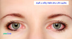 درمان عفونت چشم در شیراز
