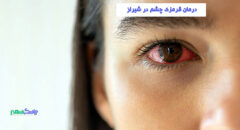 درمان قرمزی چشم در شیراز