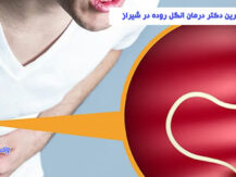 بهترین دکتر درمان انگل روده در شیراز
