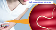 بهترین دکتر درمان انگل روده در شیراز