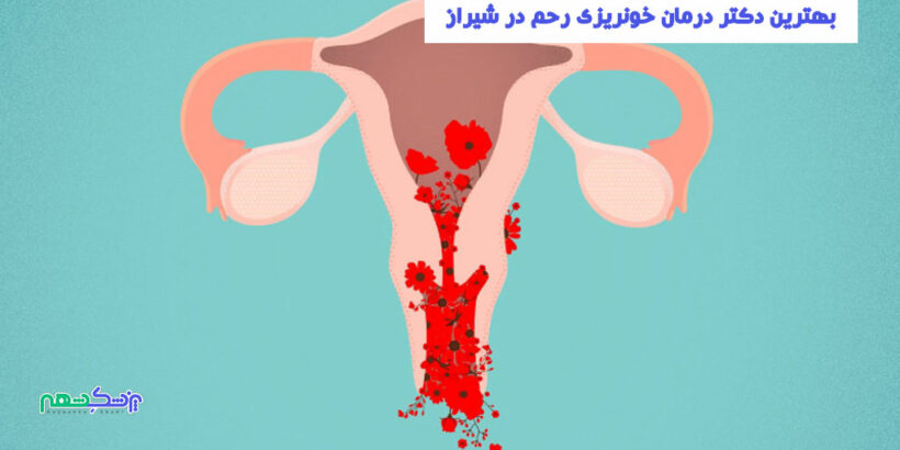 درمان خونریزی رحم در شیراز