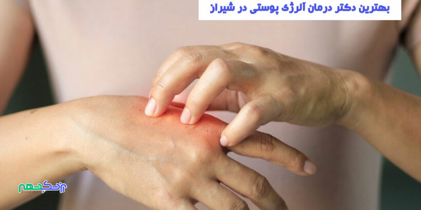 درمان آلرژی پوستی در شیراز