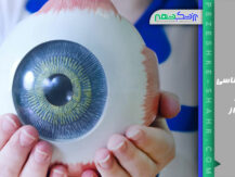 سرطان شناسی چشم در شیراز