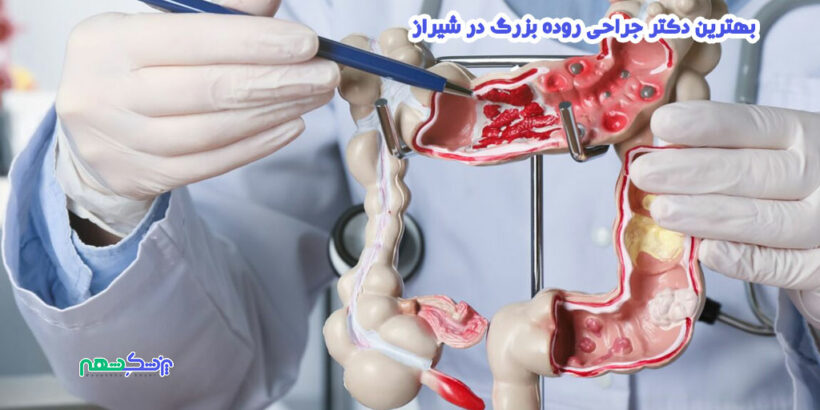 بهترین دکتر جراحی روده بزرگ در شیراز