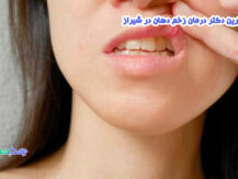 بهترین دکتر درمان زخم دهان در شیراز