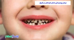 درمان پوسیدگی دندان کودکان در شیراز