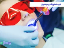 لیزر دندانپزشکی در شیراز