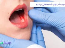 درمان آبسه دهانی در شیراز