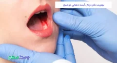 درمان آبسه دهانی در شیراز