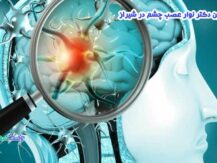 بهترین دکتر نوار عصب چشم در شیراز