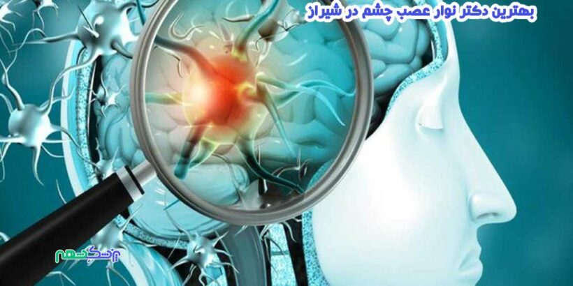 بهترین دکتر نوار عصب چشم در شیراز